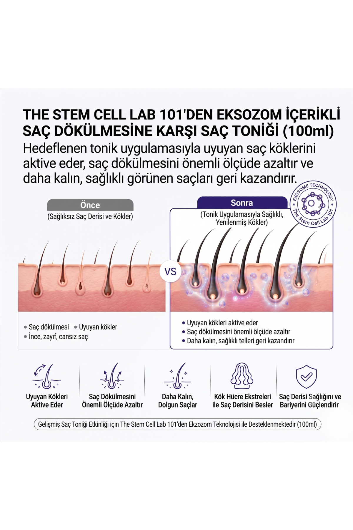 Hair Tonic | Eksozom ile Zenginleştirilmiş Saç Dökülme Karşıtı Tonik | 100ml