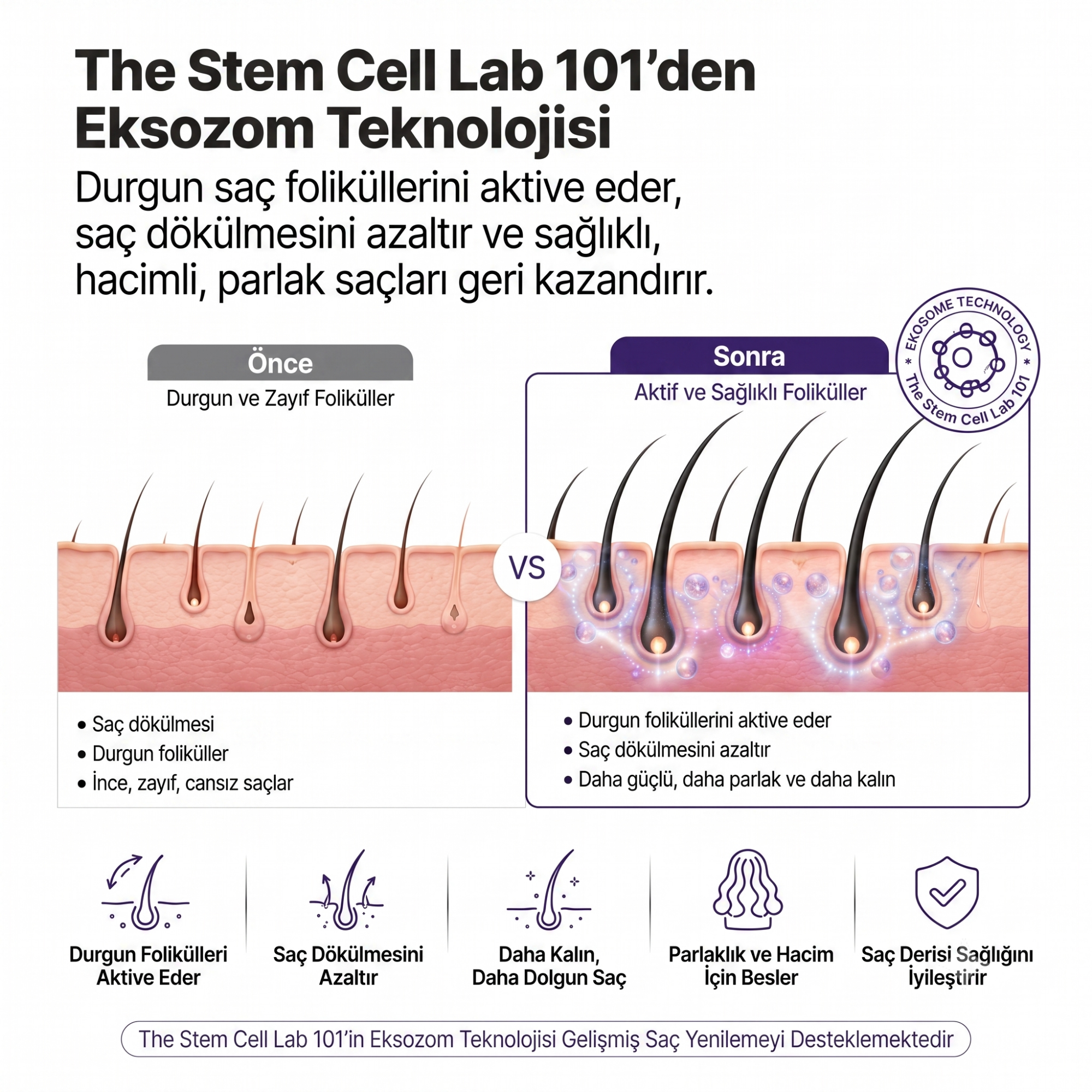 Eksozom ile Zenginleştirilmiş Hair Density Günlük Güçlendirme Seti | Anti-Hair Loss Shampoo 340ml - Anti-Hair Loss Tonic 100ml - Hair  Serum 50ml