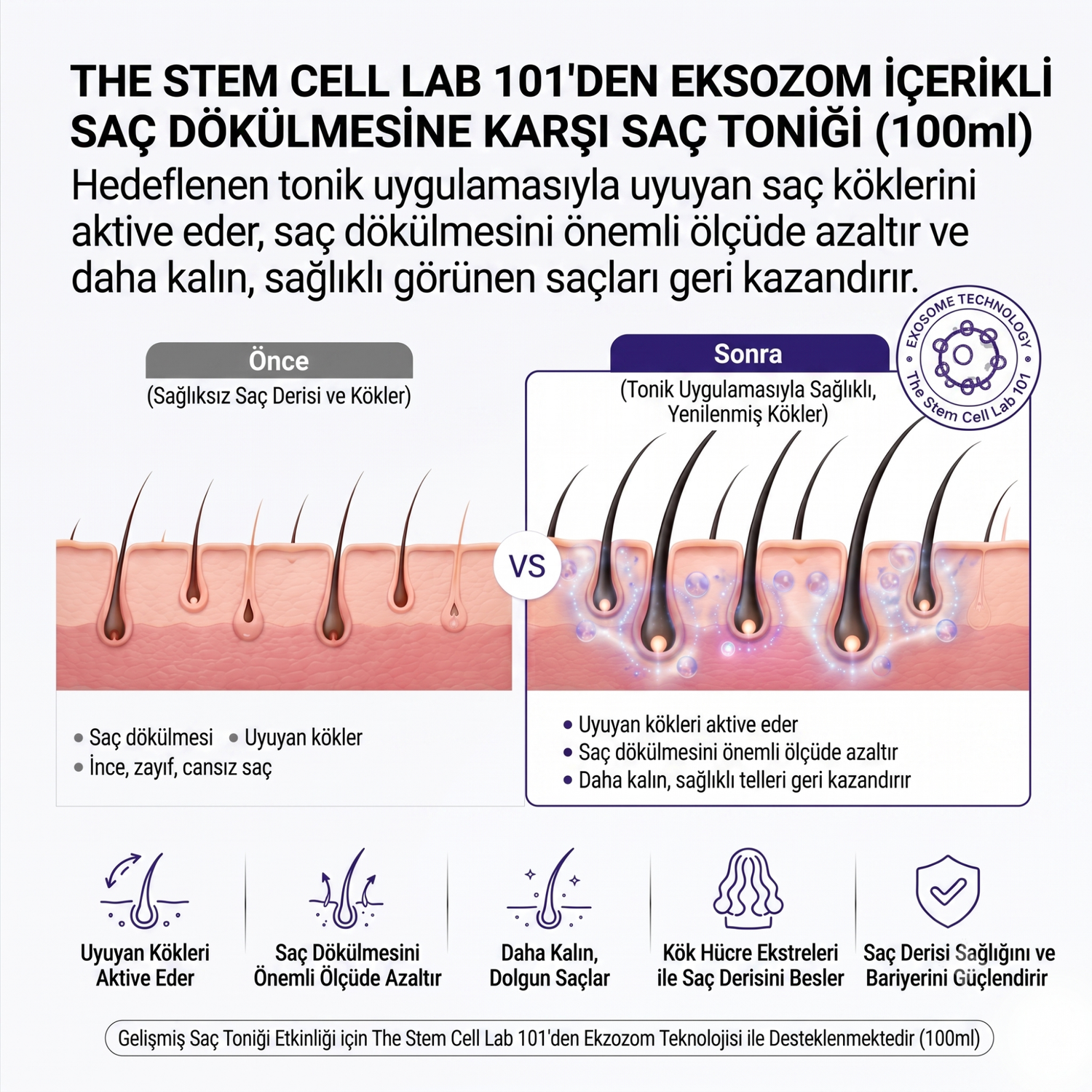 Eksozom ile Zenginleştirilmiş Saç Ekimi Sonrası Sabah Bakım Seti | Anti-Hair Loss Shampoo 340ml - Anti-Hair Loss Tonic 100ml - Hair Serum 50ml